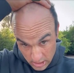 太陽報：前美國國腳多諾萬為脫發(fā)苦惱，向粉絲求助幫忙挑假發(fā)